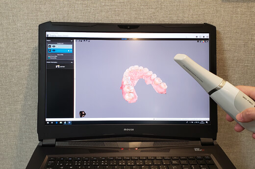大森駅・大森わたなべ歯科・3Dスキャナー