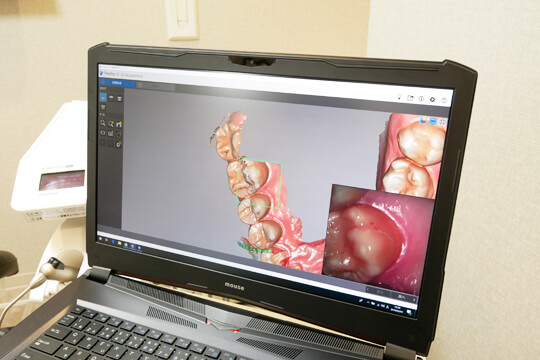 大森駅・大森わたなべ歯科・先進的な歯科用レントゲンなどによる精密検査